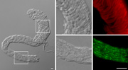 This figure shows an individual microvessel that has been partially dissociated to illustrate smooth muscle cells (labeled in red) wrapped around the underlying endothelial cell layer (labeled in green). Regions of interest from the vessel segment on the left are enlarged in panels shown on the right. The white scale bars at bottom indicate 20 micrometers, which is about half the size of a human hair.
